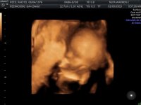 bbr-20week.jpg