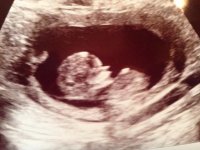 3MO.jpg