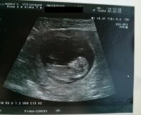 ultrasound 2.jpg