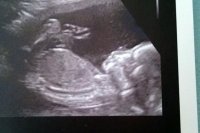 baby.jpg
