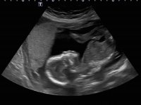 Henry ultrasound 7.jpg