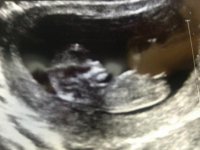 baby#3.jpg