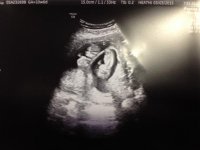 Ultrasound 03315.jpg