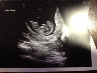 BabyA 030315.jpg