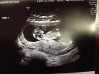 BabyB 030315.jpg