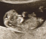 baby 3.jpeg