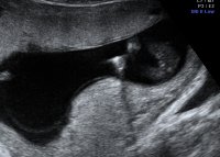 BABY LOHR_28-1.jpg