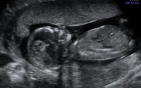 BABY LOHR_22-1.jpg