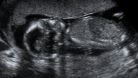 BABY LOHR_21-1.jpg