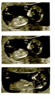 12 week scan cavey 26 mar 2015.jpg