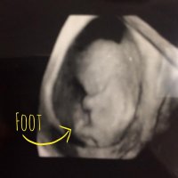 Foot.jpg