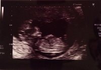 12 week scan 2.jpg