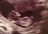 12 week scan1.jpg