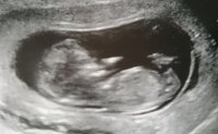 11wk 6days Baby 2.jpg