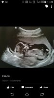 14 wks Baby 1.jpg