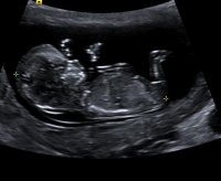 baby3.jpg