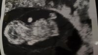 10 wk scan.jpg