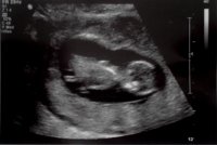 baby2-02.jpg