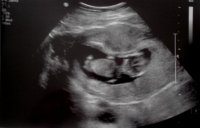 baby2-01.jpg