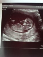 12 week scan.jpg