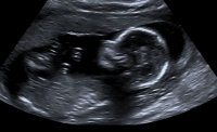 BabyB.JPG