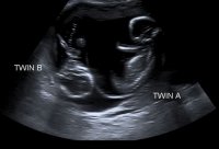BothBabies.JPG