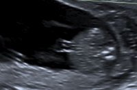 Itsaboy.JPG