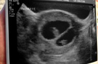 9w4d.jpg