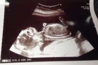 20 week scan.jpg