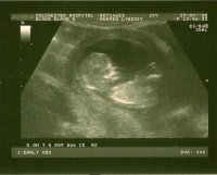 baby.jpg
