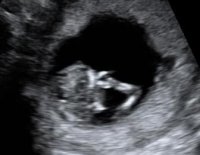 Curly's Elbow1.jpg