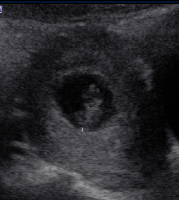 babyII-2.png