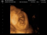 yawn.jpg