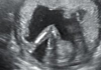 Leg2.jpg