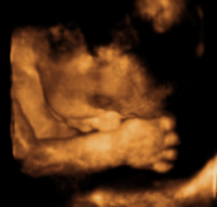no. 4 baby.PNG