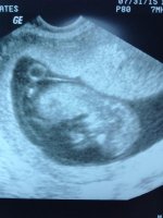 12weekultrasound.jpg