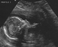 baby 19w profile.jpg