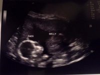 Baby Clark 2 at 18w1d.jpg