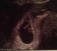 Ultrasound 7w crop.jpg