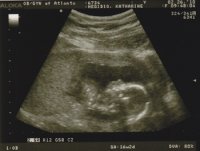 Baby_16Weeks_Profile.jpg