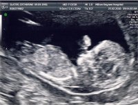 Baby Slater.jpg