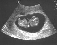 ultrasound npi.jpg