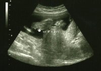 12w3d it's a boy!.jpg
