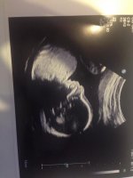 baby T 20 weeks 1.jpg