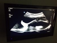 baby T 20 weeks.jpg