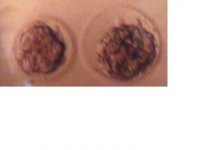 embryos.jpg