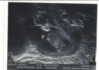 Baby01.jpg