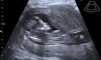 babyscan2.jpg