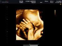 UC BABY_0010.jpg