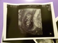 baby scan 10+4.jpg